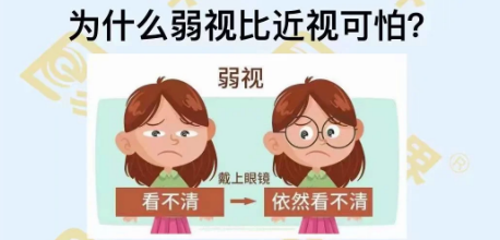 為什么弱視比近視可怕？