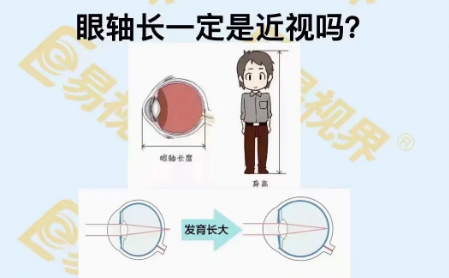 眼軸長一定是近視嗎？