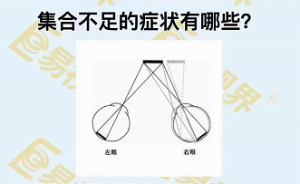 集合不足的癥狀有哪些？